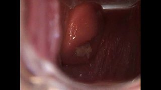 Avy Öppna Fitta med Speculum