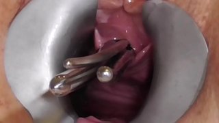 ���ವ್ಯಾಸಿ FreyjaAnalslut: ರಾಡ್ ರಲ್ಲಿ Freyja ನ pisshole